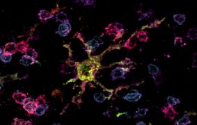 Interaction entre lymphocytes T folliculaires et macrophages