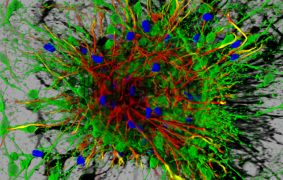 Neurones générés à partir de cellules souches embryonnaires de souris