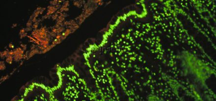 Lactobacillus casei, quels gènes pour coloniser l'intestin